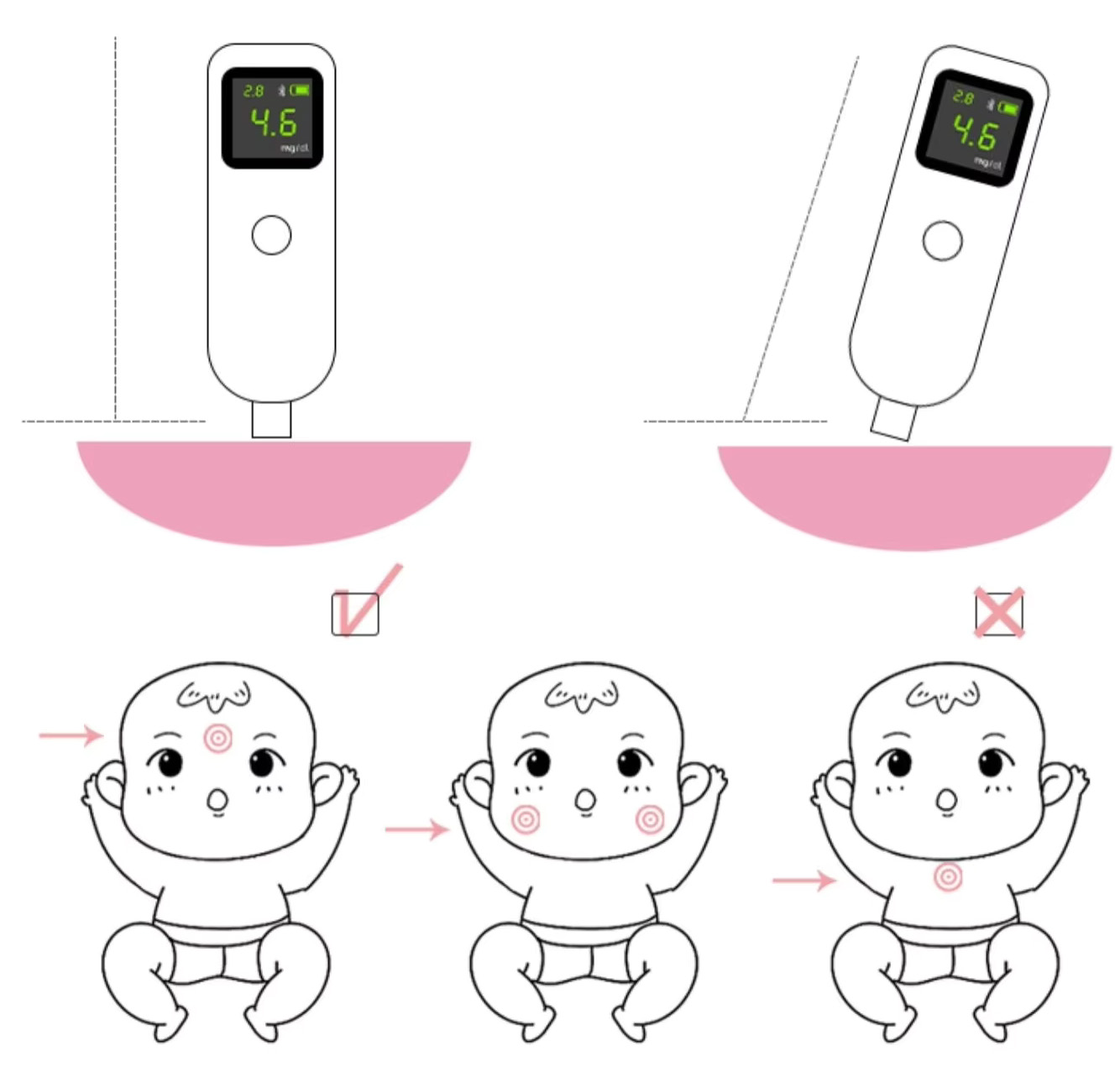 Luckcome L11C neonatale geelzuchtmeter, bilirubinemeter en geelzucht‑detector